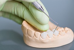 a dental bridge on a plaster mold of a mouth