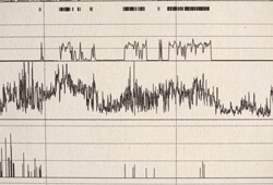 sleep test results