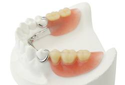 Partial denture on smile model