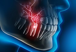 Animation of tooth with lightnight bolt