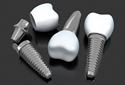 three dental implants with abutments and crowns