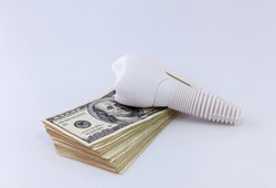 dental implant on money