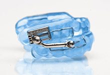 Herbst sleep apnea appliance
