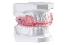 DynaFlex sleep apnea appliance