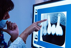 Dental x-rays on computer screen