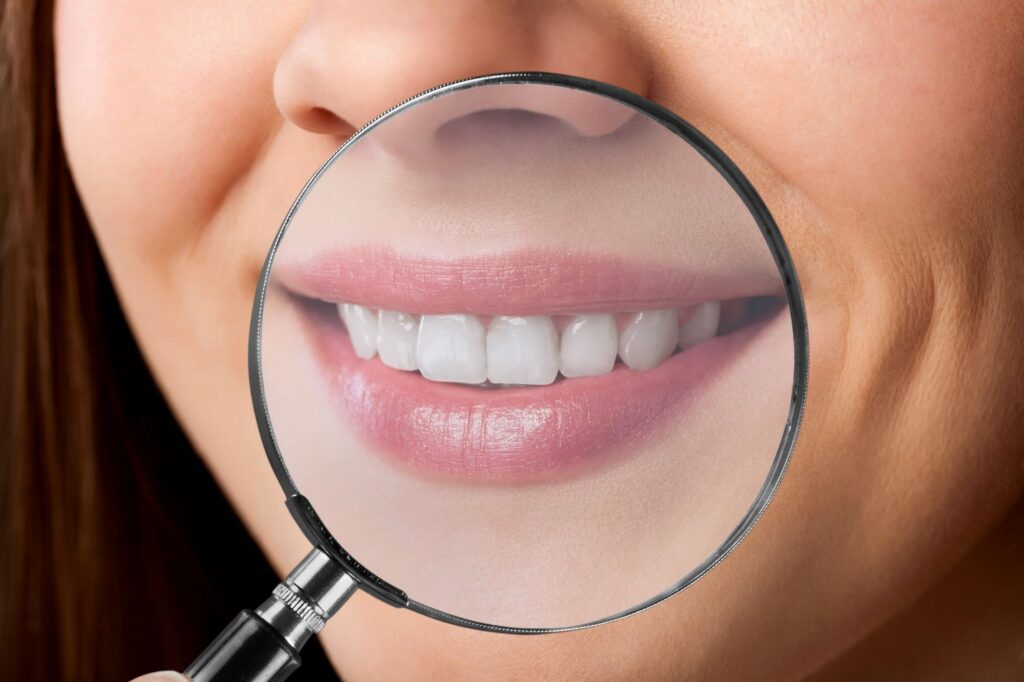 Magnifying glass held up to woman's somewhat gray smile
