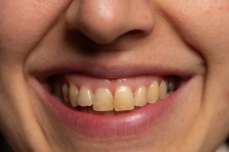A closeup of a mouth with yellow teeth
