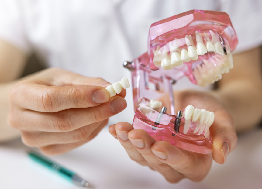 Hands holding dental bridge/denture model