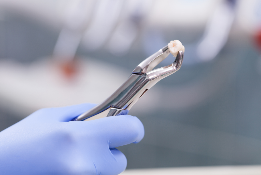 Tooth on forceps